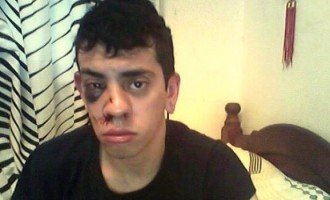 Atacaron a un joven por ser homosexual