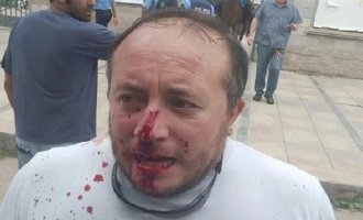 Una patota atacó a trabajadores estatales en Mendoza