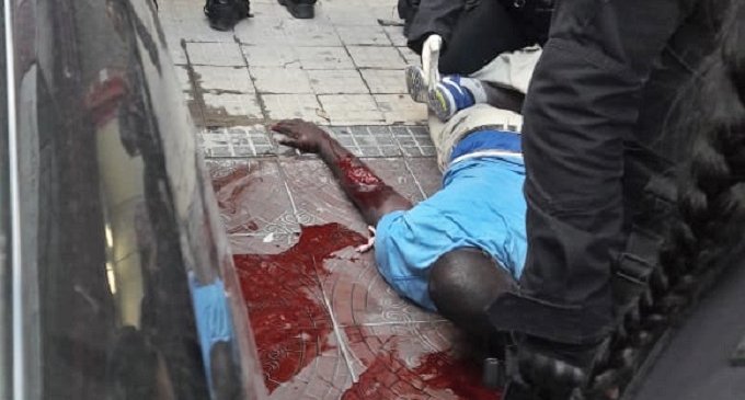 La policía de la Ciudad desalojó e hirió de gravedad a un vendedor senegalés